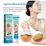 Lipoma Removal Cream | South Moon Lipoma Treatment Ointment - Image 4
